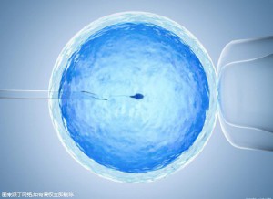液氮储存